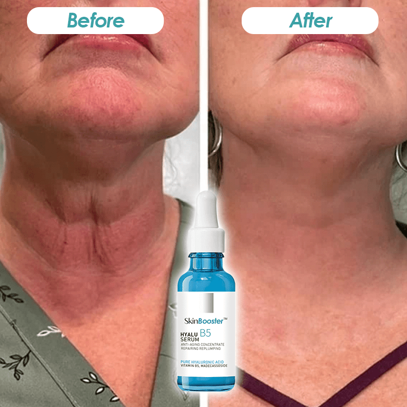 SkinBooster™ Rapid Wrinkle Erase Botox Face Serum