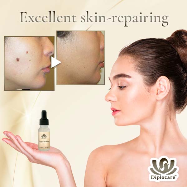 Diplocare™ Organic Skin Spots Corrector Serum